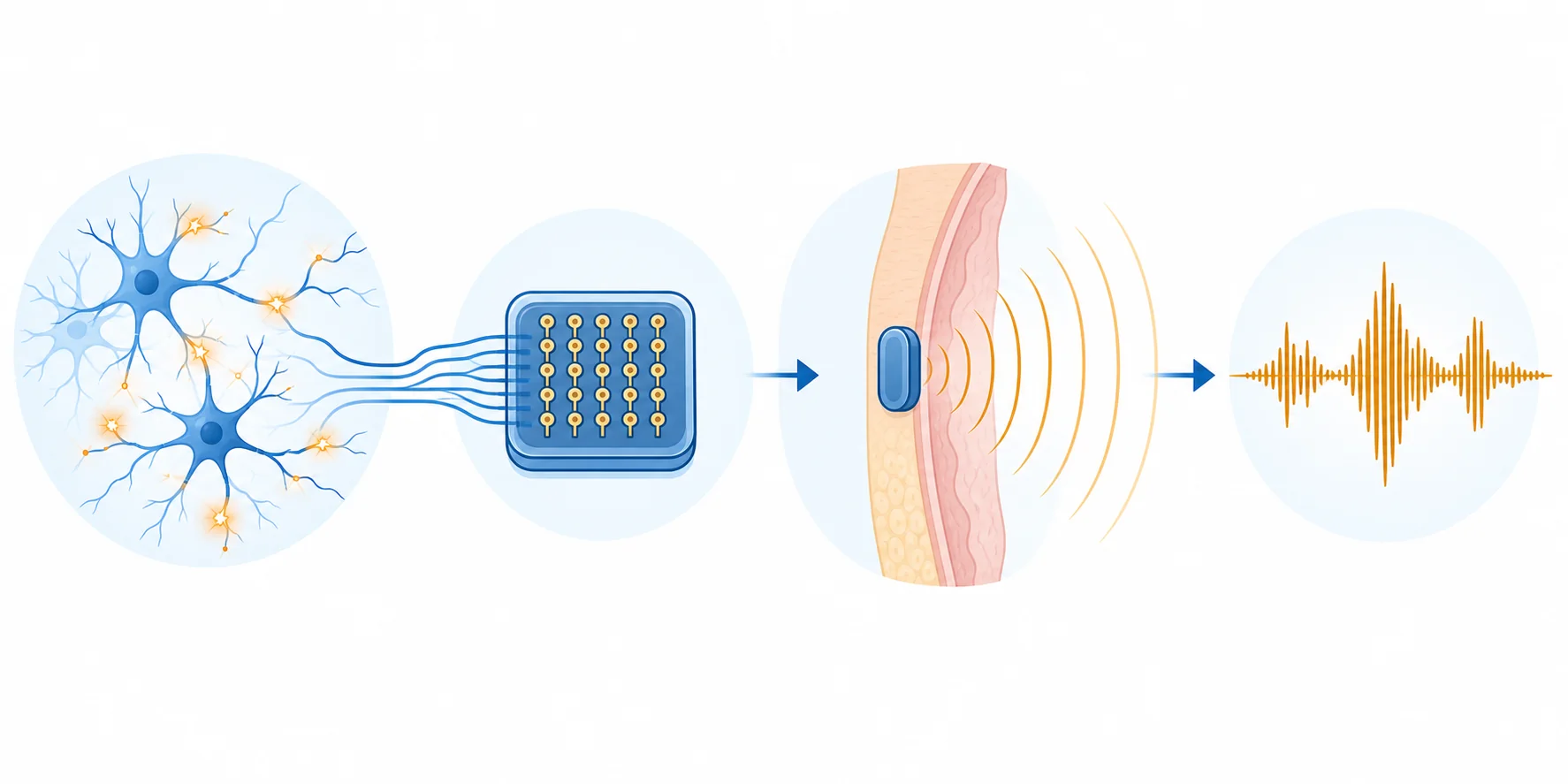 How a speech-restoring brain implant decodes neural signals into synthesized speech